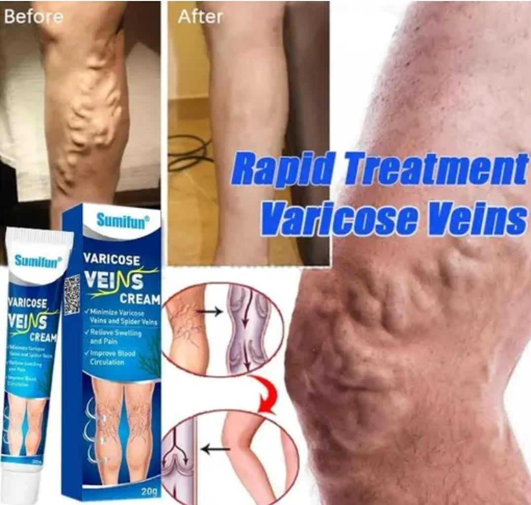 Varicose vein Cream DM629