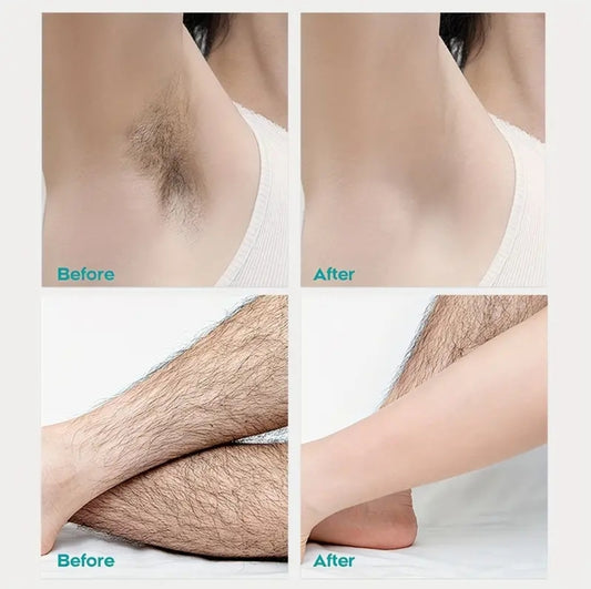 Hair removal spray DM174