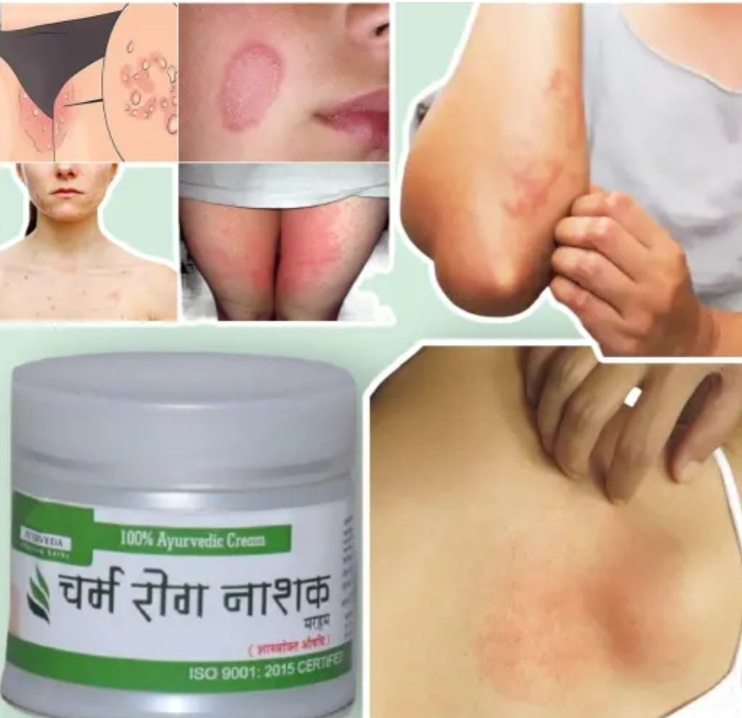 Charam Rog Balm DM215